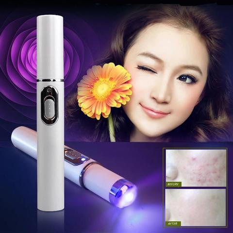 Exclusive Blue Light Therapy Acne Treatment Pen — Have a logo — Lifestyle View