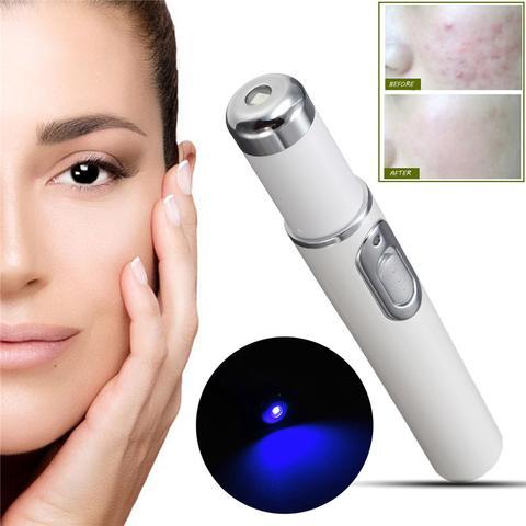 Exclusive Blue Light Therapy Acne Treatment Pen — Have a logo — Side View