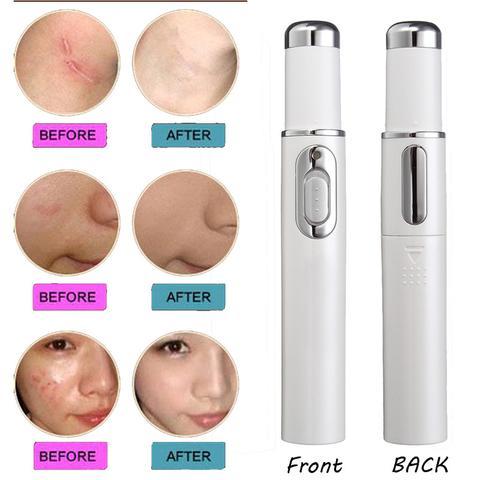 Exclusive Blue Light Therapy Acne Treatment Pen — Have a logo — Detail View