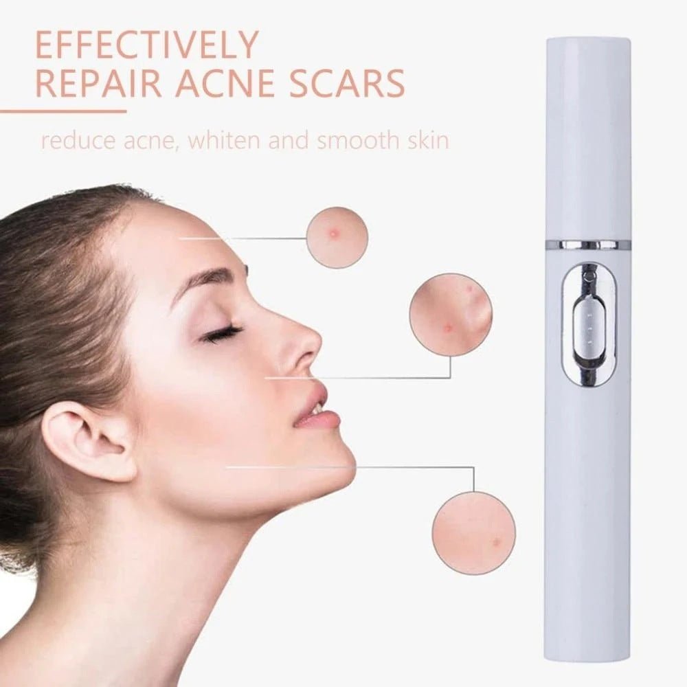 Exclusive Blue Light Therapy Acne Treatment Pen — Have a logo — Alternate View 11
