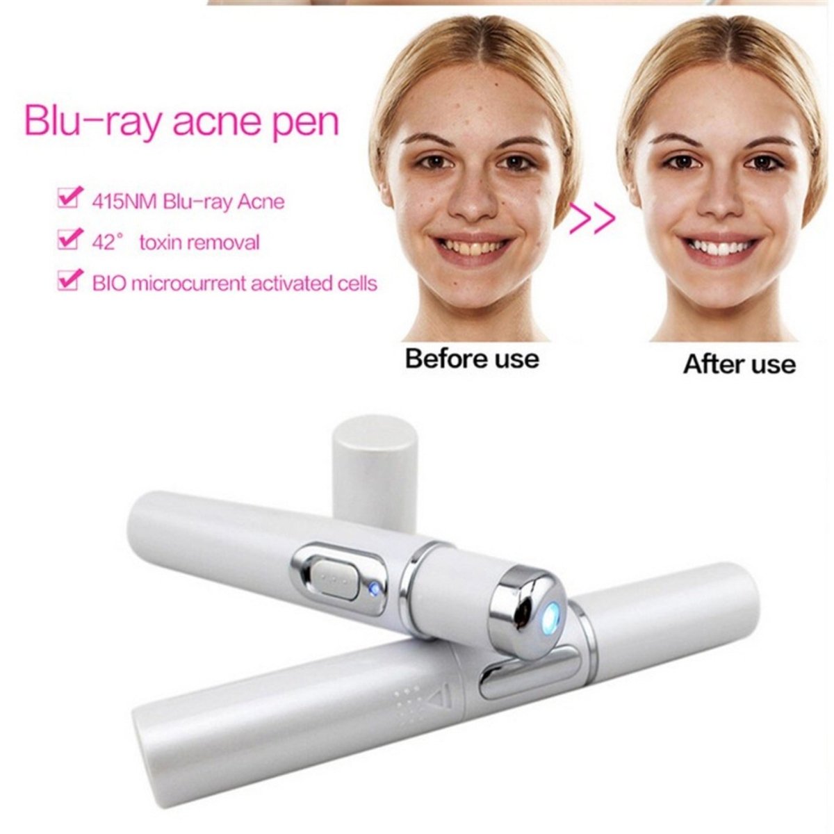 Exclusive Blue Light Therapy Acne Treatment Pen — Have a logo — Alternate View 9